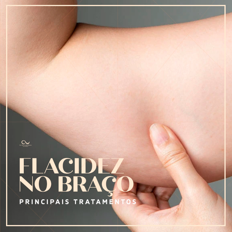 Flacidez nos Braços: Principais Tratamentos - Dra. Ana Carulina Moreno